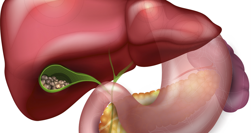 Cirugías del tracto gastrointestinal